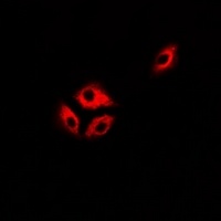 ASL Rabbit Polyclonal Antibody