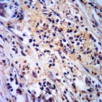 CAT1 Rabbit Polyclonal Antibody