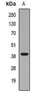 LIMS1 Antibody