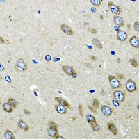OGDH Rabbit Polyclonal Antibody