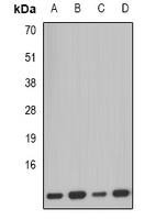 PCBD1 Rabbit Polyclonal Antibody