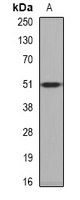 PPOX Rabbit Polyclonal Antibody