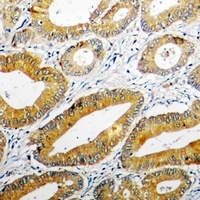 PPOX Rabbit Polyclonal Antibody