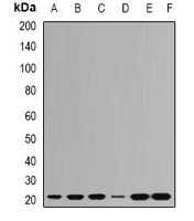 RPL9 Rabbit Polyclonal Antibody