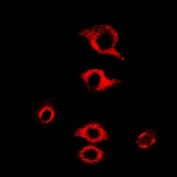 RPL9 Rabbit Polyclonal Antibody