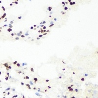 RNGTT Antibody
