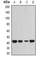 SEPHS1 Rabbit Polyclonal Antibody