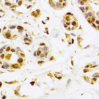 SEPHS1 Rabbit Polyclonal Antibody