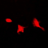 SEPHS1 Rabbit Polyclonal Antibody