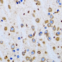 PTRH2 Antibody