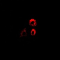 PTRH2 Antibody