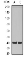 HAO1 Rabbit Polyclonal Antibody