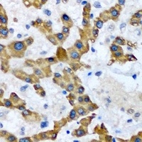 HAO1 Rabbit Polyclonal Antibody