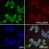 HAO1 Rabbit Polyclonal Antibody