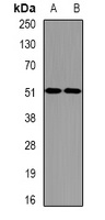 eIF2S3 Rabbit Polyclonal Antibody