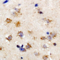eIF2S3 Rabbit Polyclonal Antibody