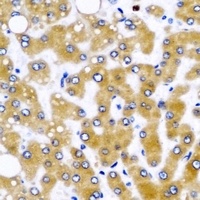 GLUD2 Rabbit Polyclonal Antibody