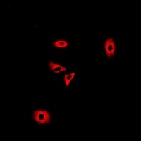 GLUD2 Rabbit Polyclonal Antibody