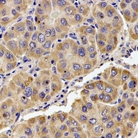KIF1B Rabbit Polyclonal Antibody