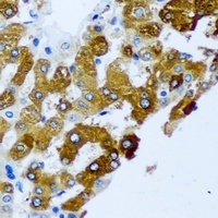 KIF3A Rabbit Polyclonal Antibody