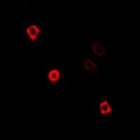 KIF3A Rabbit Polyclonal Antibody