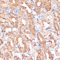 Malin Rabbit Polyclonal Antibody