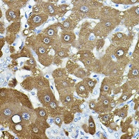 NNMT Rabbit Polyclonal Antibody