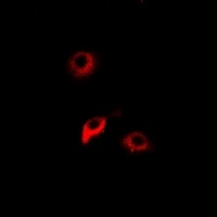NNMT Rabbit Polyclonal Antibody