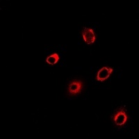 PCMT1 Rabbit Polyclonal Antibody