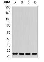 RPL13 Rabbit Polyclonal Antibody