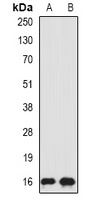 SRP19 Rabbit Polyclonal Antibody