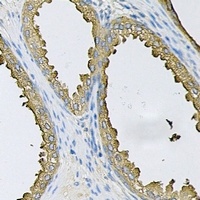 SRP19 Rabbit Polyclonal Antibody