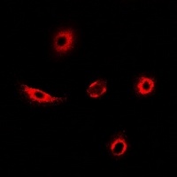Transgelin-2 Rabbit Polyclonal Antibody
