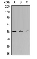 TREX1 Rabbit Polyclonal Antibody