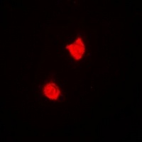 TREX1 Rabbit Polyclonal Antibody