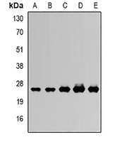 RISP Rabbit Polyclonal Antibody