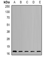 NUDT2 Rabbit Polyclonal Antibody