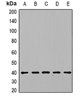 DGUOK Rabbit Polyclonal Antibody