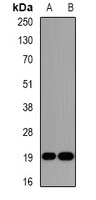 DR1 Rabbit Polyclonal Antibody