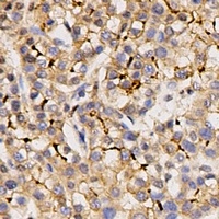 Kv4.3 Rabbit Polyclonal Antibody