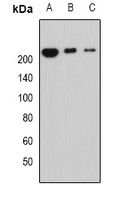 Periplakin Rabbit Polyclonal Antibody