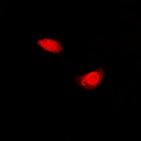 Periplakin Rabbit Polyclonal Antibody