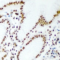 RbAp46 Rabbit Polyclonal Antibody