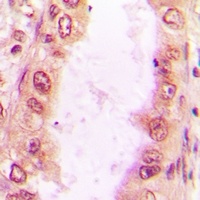 Sm-D2 Rabbit Polyclonal Antibody