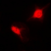 Sm-D2 Rabbit Polyclonal Antibody
