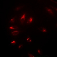 NELF-E Rabbit Polyclonal Antibody