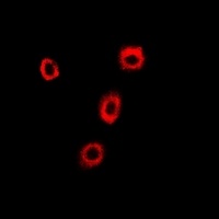 p102 Rabbit Polyclonal Antibody