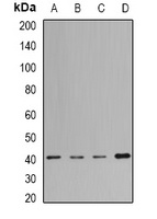 MacroH2A1 Rabbit Polyclonal Antibody