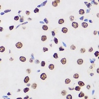 MacroH2A1 Rabbit Polyclonal Antibody