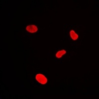 MacroH2A1 Rabbit Polyclonal Antibody
